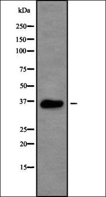 Rsu-1 antibody