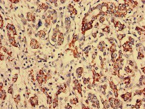 RTCA Antibody