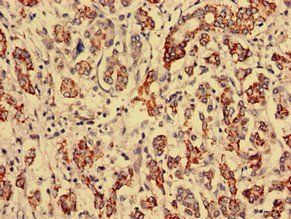 RTCA antibody