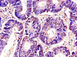 RTCB Antibody