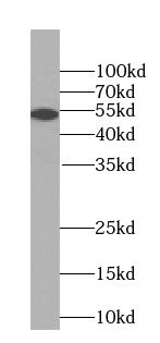 RtcB-Specific antibody