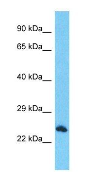 RTFDC1 antibody