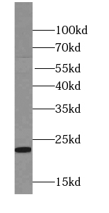 RTN1 (Isoform RTN1-C) antibody