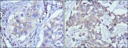 RTN3 Antibody