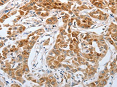 RTN4 antibody