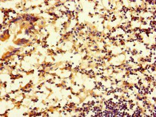 RTN4IP1 Antibody
