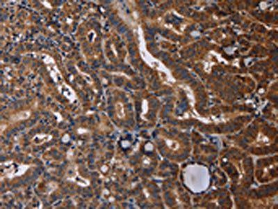 RTN4R Antibody