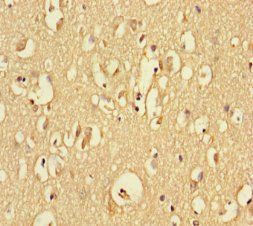RTN4RL1 Antibody