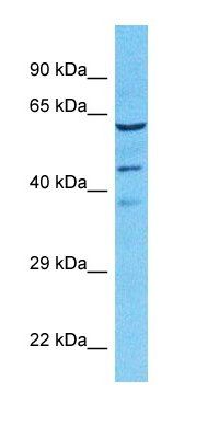 RU17 antibody