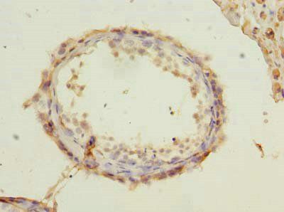 RUNDC3A Antibody