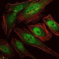 RUNX1 Antibody