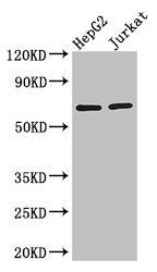 RUNX1T1 antibody