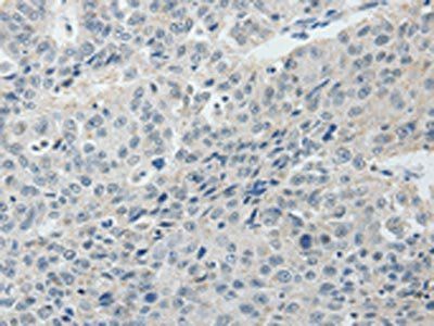 RUNX3 antibody