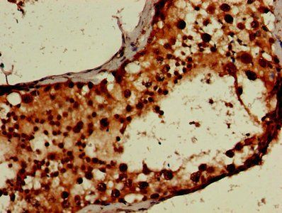 RUVBL2 Antibody