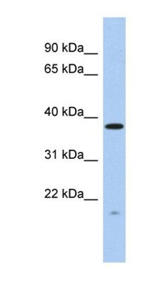 RWDD2A antibody
