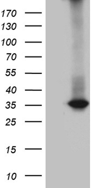 RWDD3 antibody