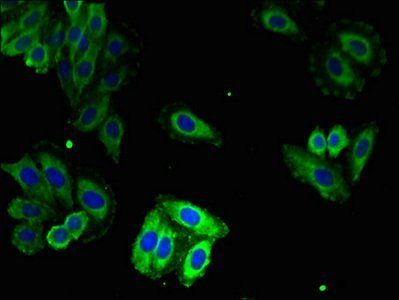 Ryanodine R 1 antibody