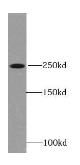 Ryanodine Receptor 2 antibody
