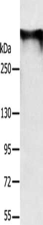 RYR1 antibody