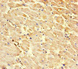 RYR2 Antibody