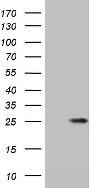 S100 alpha 6 (S100A6) antibody