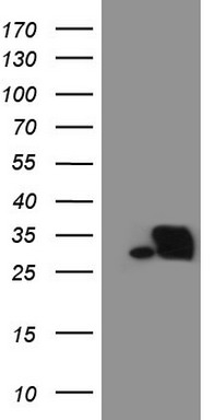 S100 beta (S100B) antibody