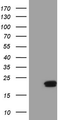 S100 calcium binding protein A14 (S100A14) antibody