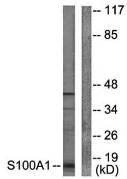 S100A1 antibody