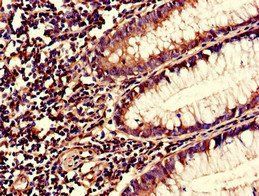 S100A10 Antibody