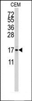 S100A11 antibody