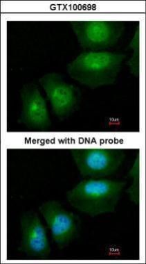 S100 calcium binding protein A11 Antibody