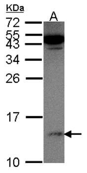 S100A11 antibody