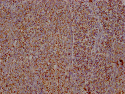 S100A12 antibody