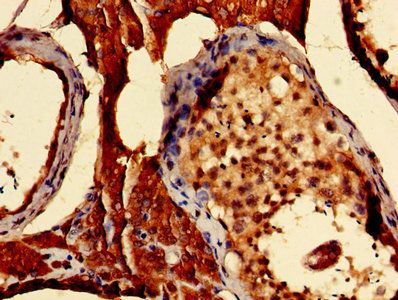 S100A16 Antibody
