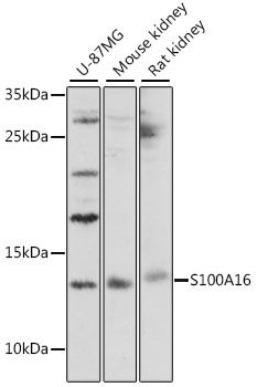 S100A16 antibody