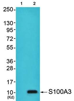 S100A3 antibody