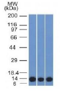 S100A4 / Metastasin / Calvasculin (Marker of Tumor Metastasis) Antibody