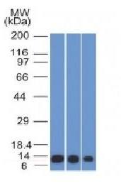 S100A4 / Metastasin / Calvasculin (Marker of Tumor Metastasis) Antibody
