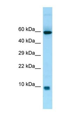 S100A7A antibody