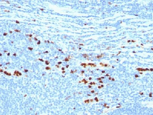 Calprotectin / MRP14 / S100A9 / Calgranulin B Antibody