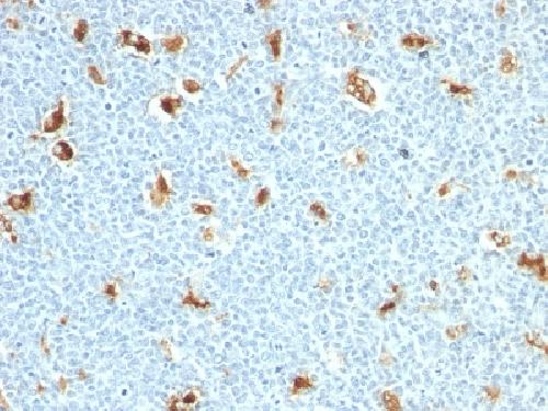 Calprotectin / MRP14 / S100A9 / Calgranulin B Antibody