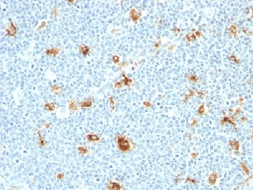 Calprotectin / MRP14 / S100A9 / Calgranulin B Antibody