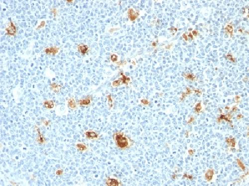 S100A9 antibody