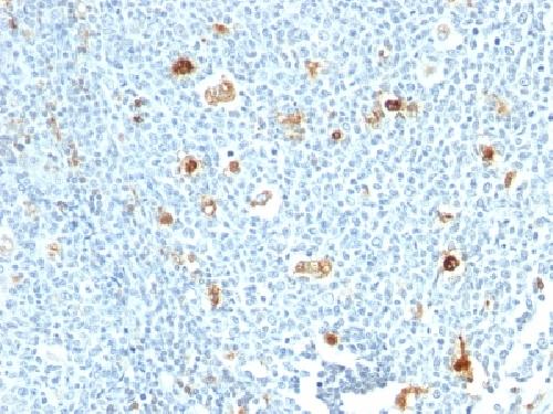 Calprotectin / MRP14 / S100A9 / Calgranulin B Antibody