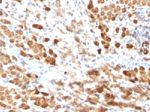 S100B (Astrocyte and Melanoma Marker) Antibody
