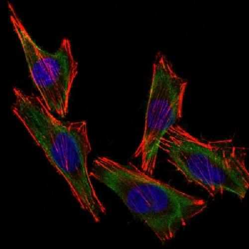 S100B antibody