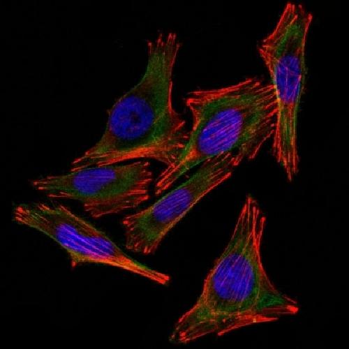 S100B antibody