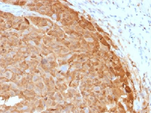 Recombinant S100B (Astrocyte and Melanoma Marker) Antibody