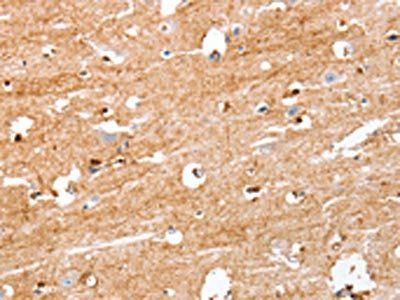 S100B Antibody