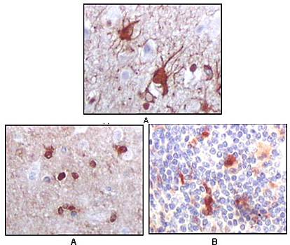 S100B Antibody